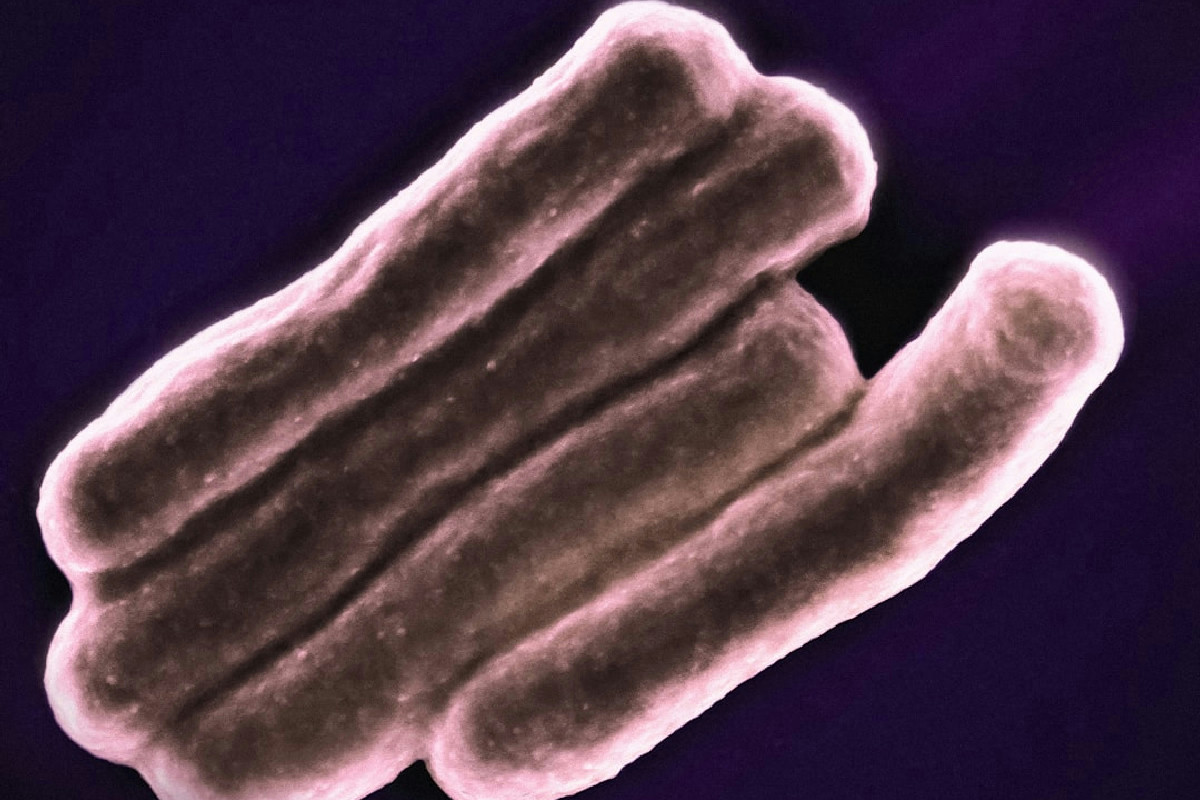 Legionella nei condizionatori: ecco perché il pericolo è alle stelle e come proteggere la famiglia